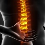 X ray image of a person with lower back pain