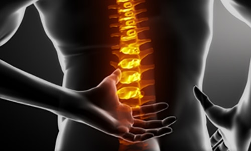 X ray image of a person with lower back pain