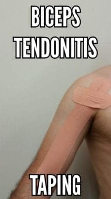 Biceps tendonitis