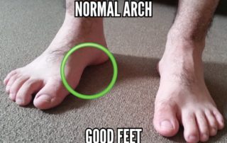 normal-arch