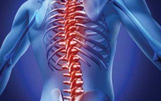 What is a bulging disc?causes and treatment 5 cervical spine, spinal conditions, lumbar spine, laminectomy, discectomy