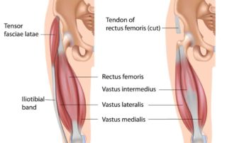 ITB, PFP, Iliotibial band