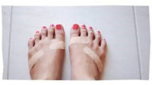 picture of bandaged feet