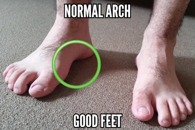 normal-arch