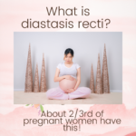 What is diastasis recti