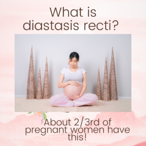 What is diastasis recti