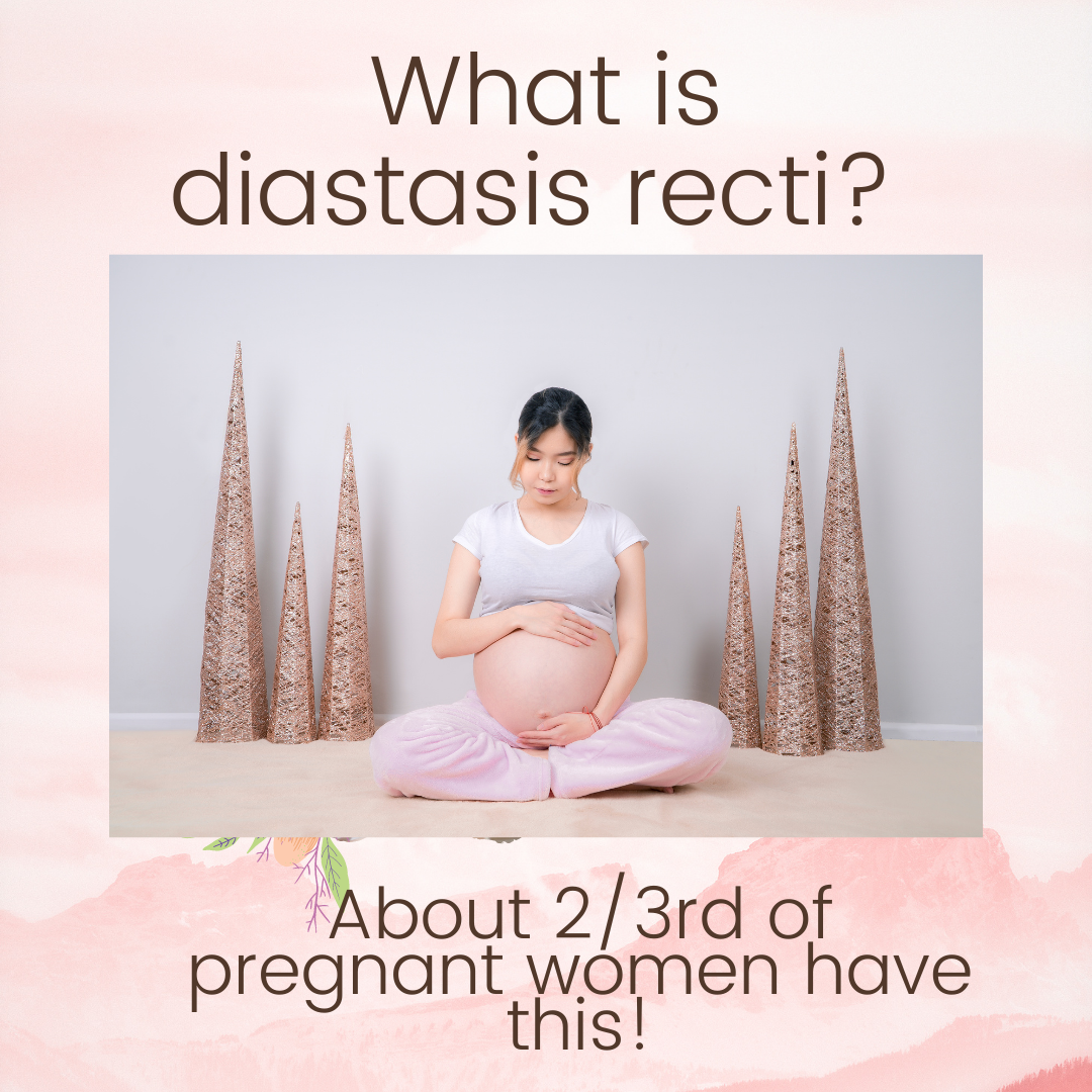 What is diastasis recti