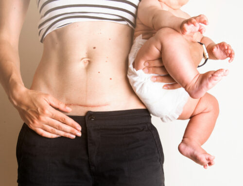 Why is Physiotherapy so important postpartum?