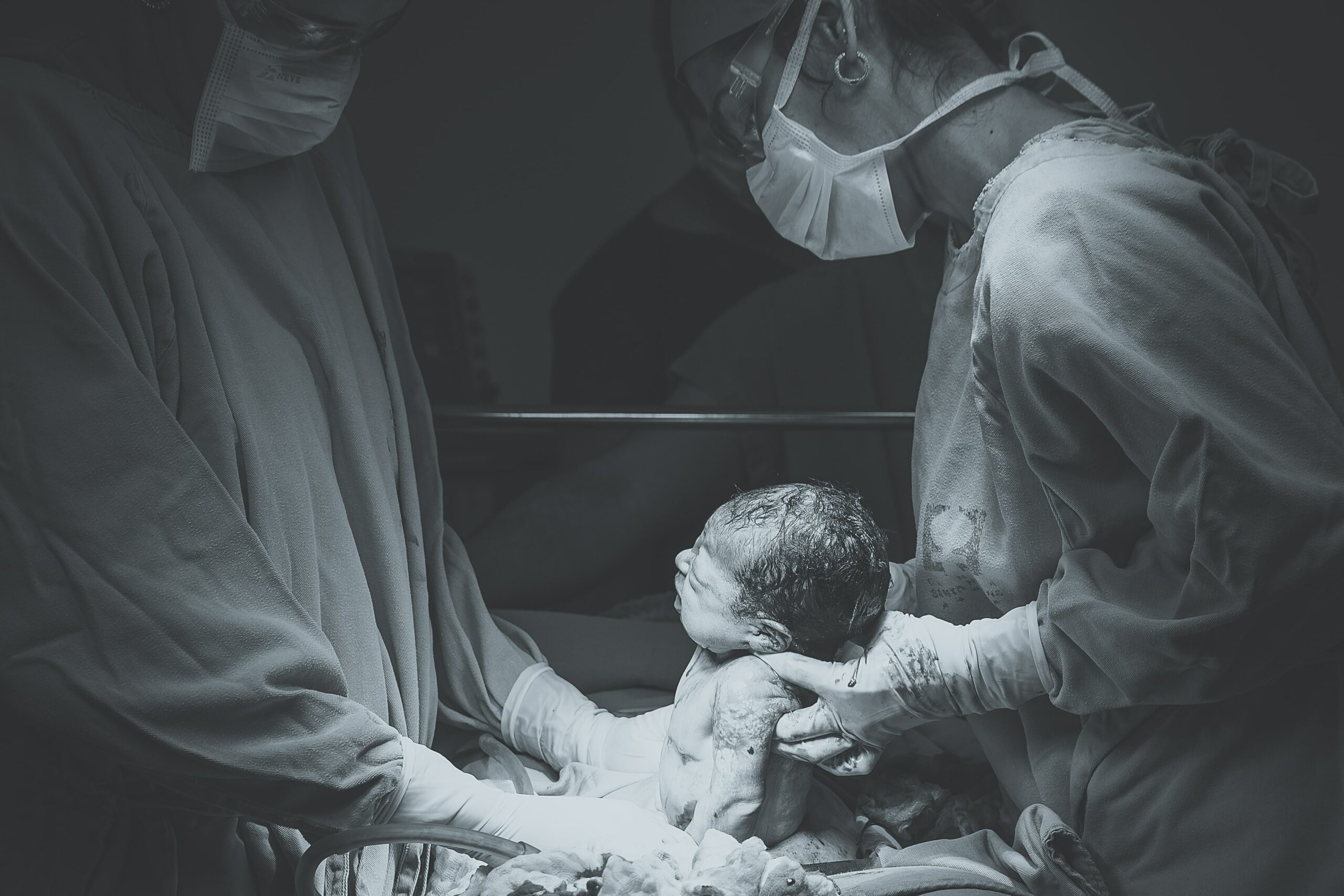 picture of c section
