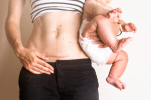c section